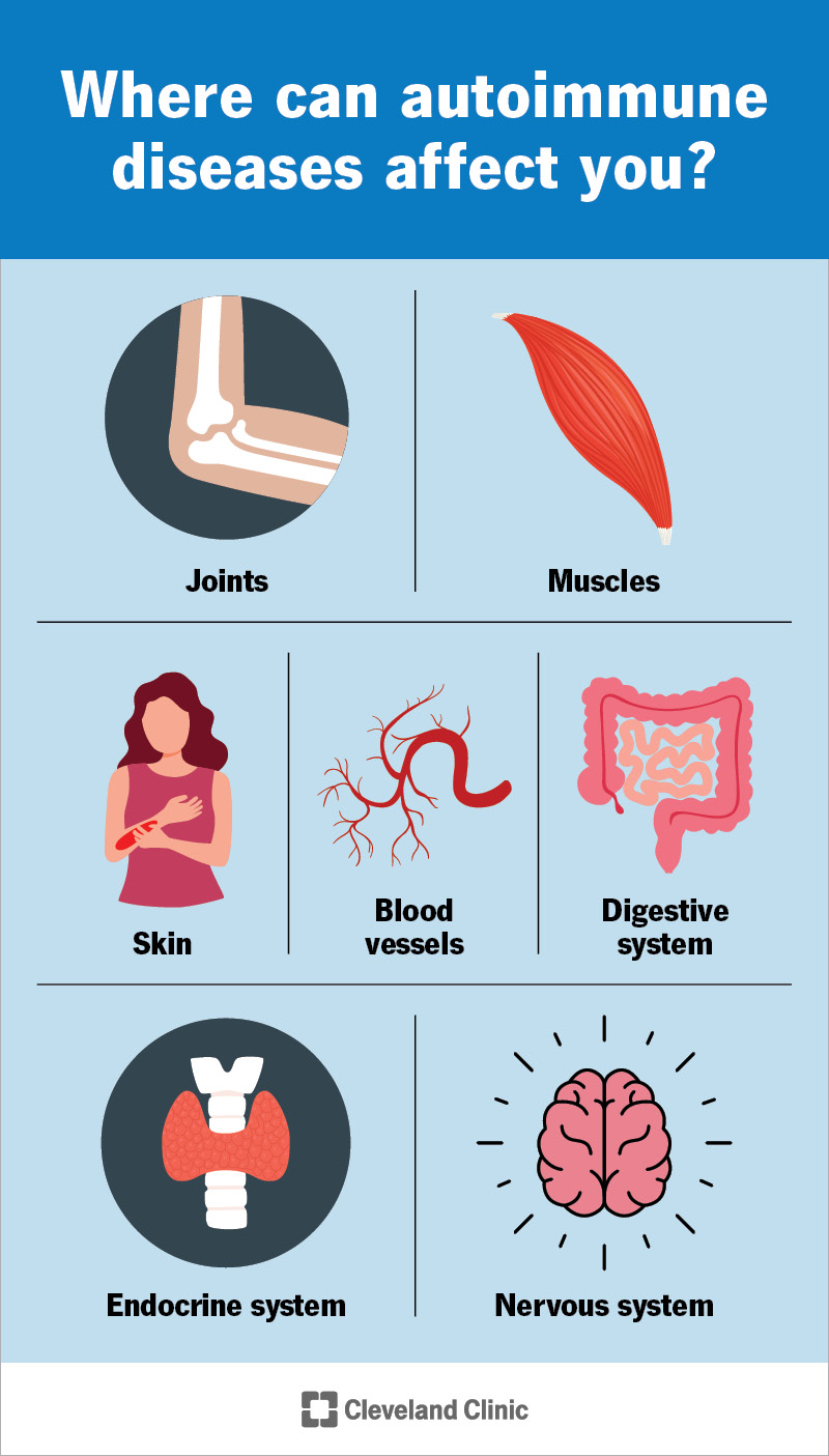 <p>Where can autoimmune diseases effect you</p>