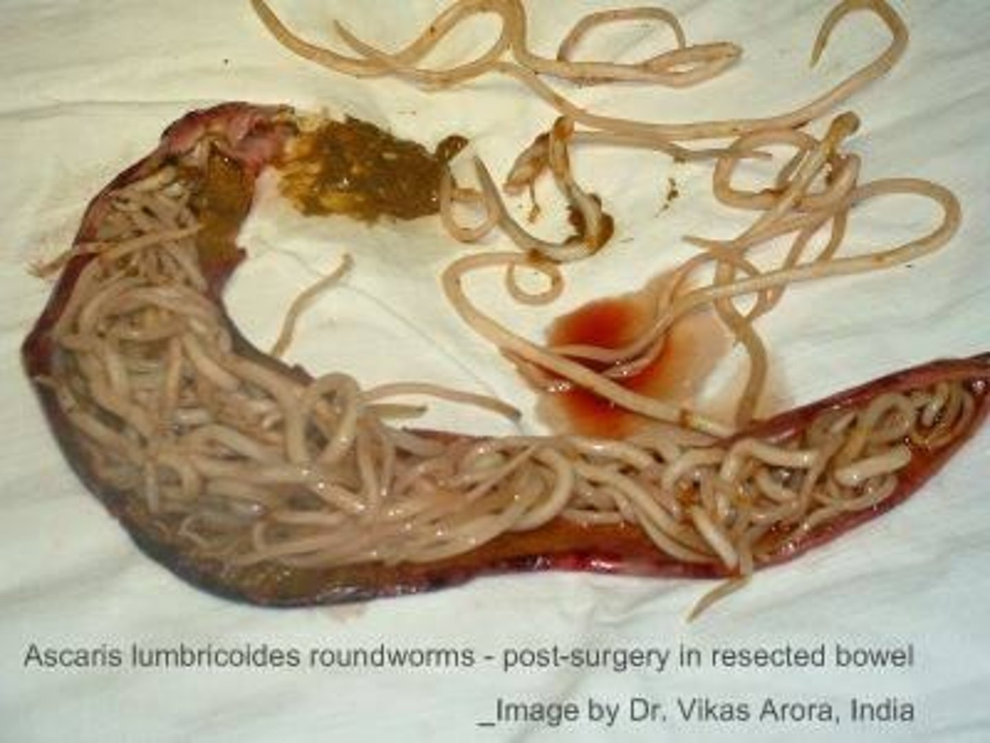 <p>Ascaris lives in the intestines of its host, where the female lays eggs that exit the host through feces.</p>