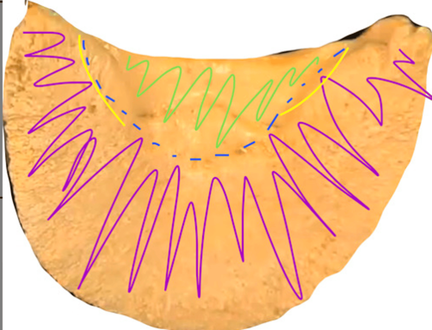 <p>this is the sole of the distal phalanx. the surface in green is called...</p>