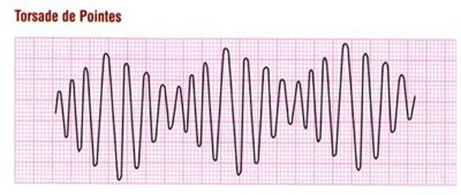 <p>Long QT Syndrome (Gone Wrong)</p>