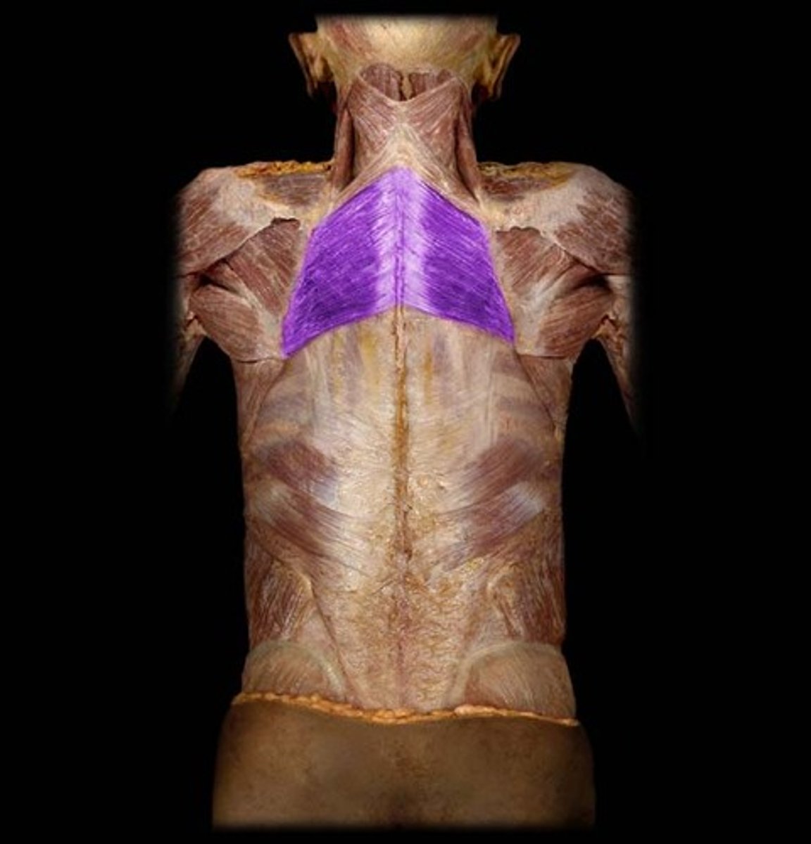 <p>O: Vertebrae</p><p>I: Medial border</p><p>A: Retracts scapula</p>