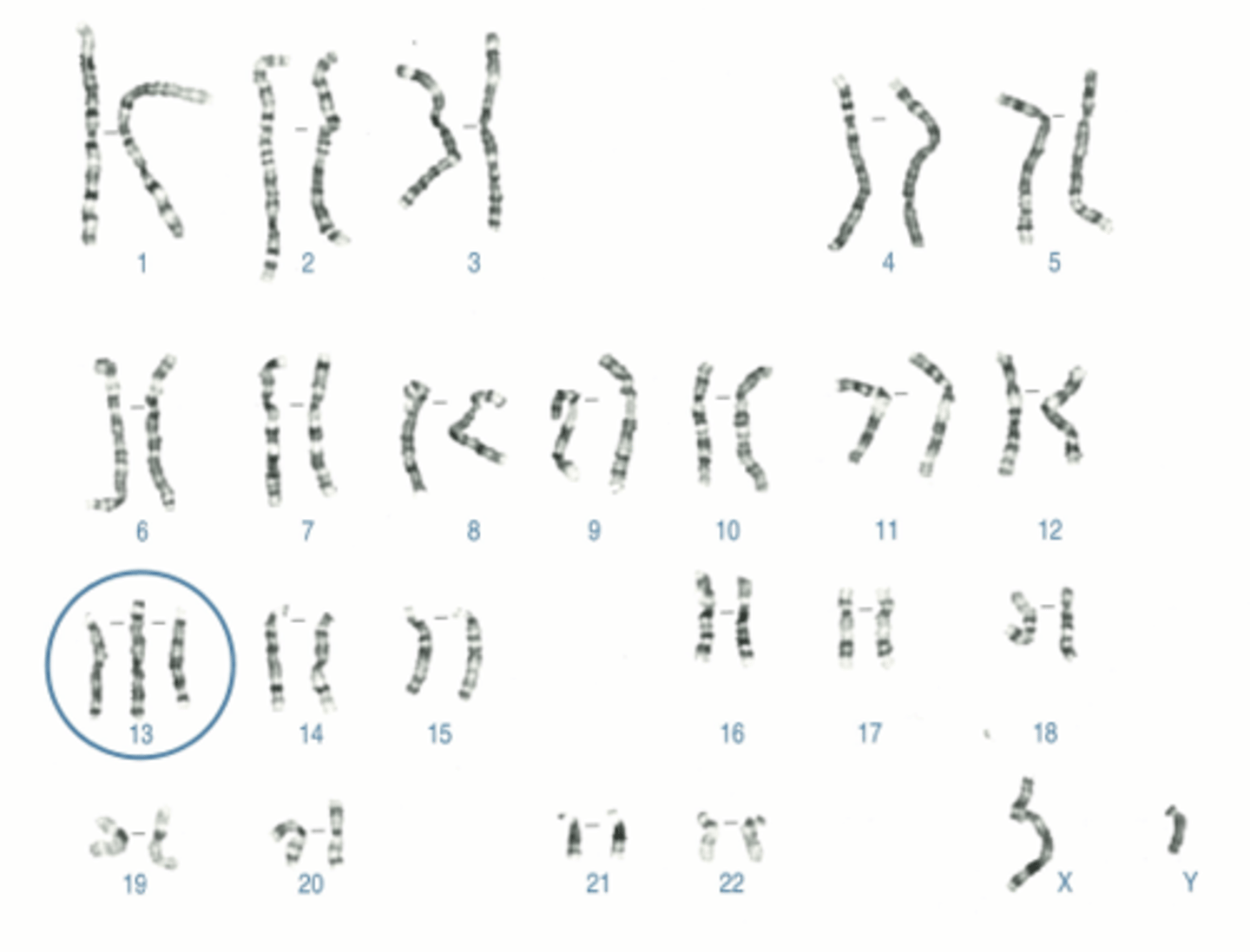 <p>Name:</p><p>- Correctly written karyotype</p><p>- Common name</p><p>- Scientific name</p><p>- One distinguishing clinical feature</p><p>- Definition of this feature if not obvious</p>