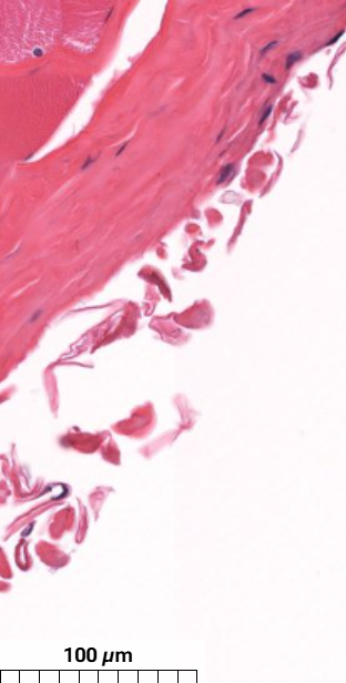 <p>What part of the skeletal muscle is this?</p>