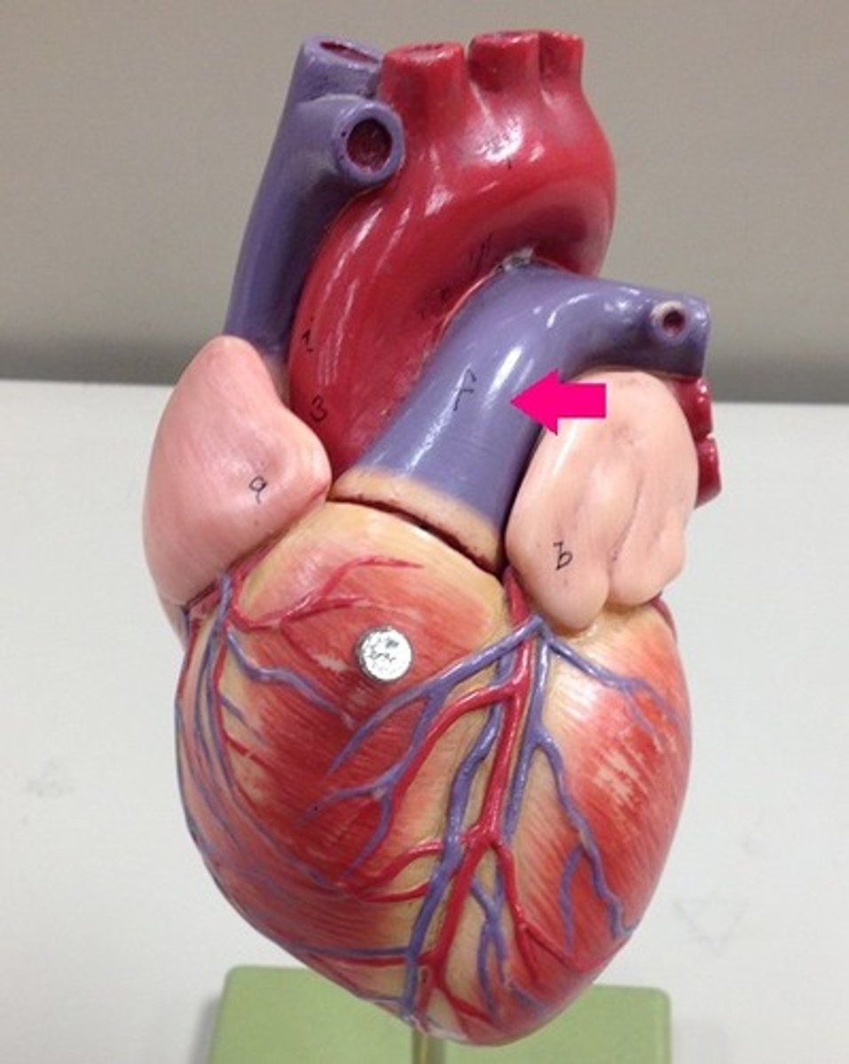 <p>Identify the vessel.</p>