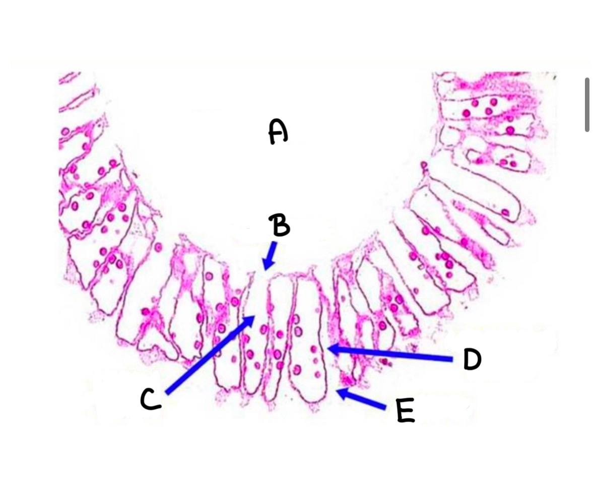 <p>What part of the Grantia is labeled C</p>