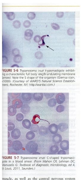 <p>What disease does Trypanosoma brucei cause?</p>