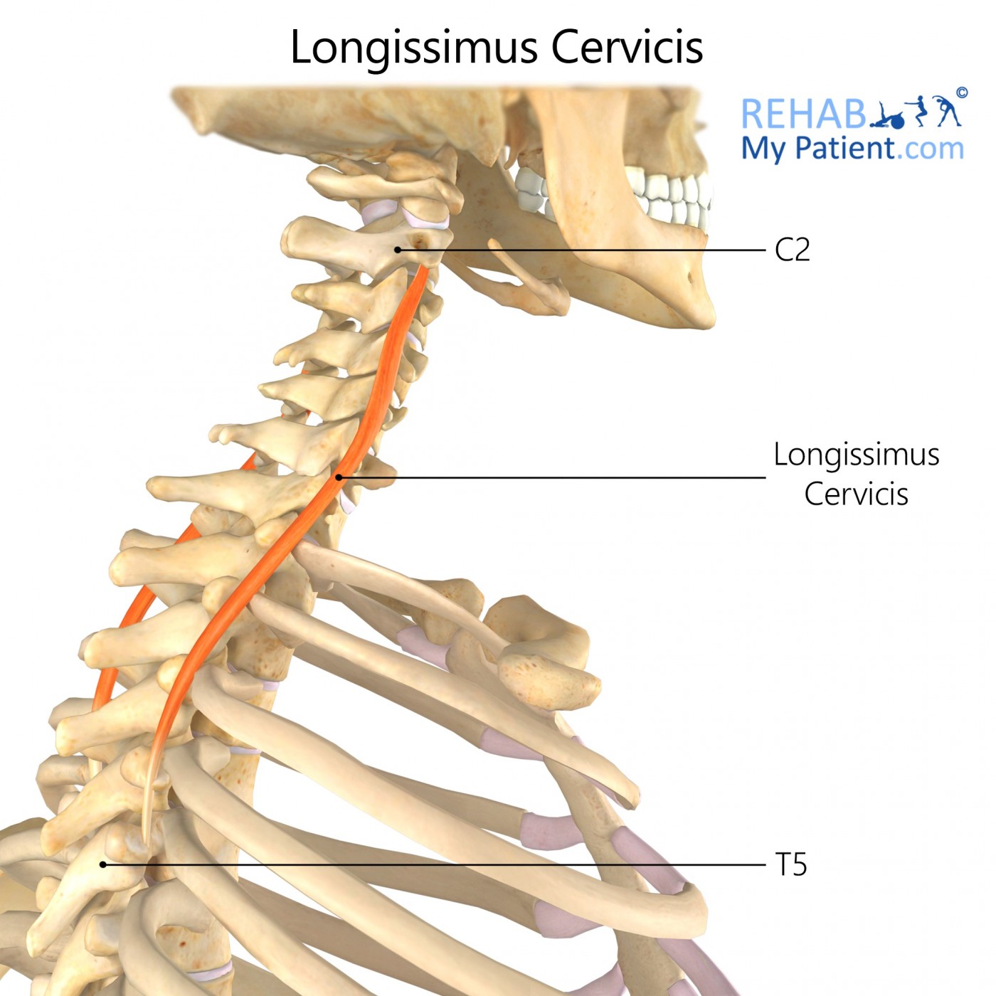 <p><strong>Proximal Attachment</strong></p><p><span>Upper 4 or 5 thoracic transverse processes</span></p><p><strong>Distal Attachment</strong></p><p>Posterior tubercles of transverse processes of C2-C6</p><p><strong>Peripheral Innervation</strong></p><p>posterior rami of spinal nerves</p><p><strong>Action</strong></p><p>Extension, lateral flexion of spine/head</p>