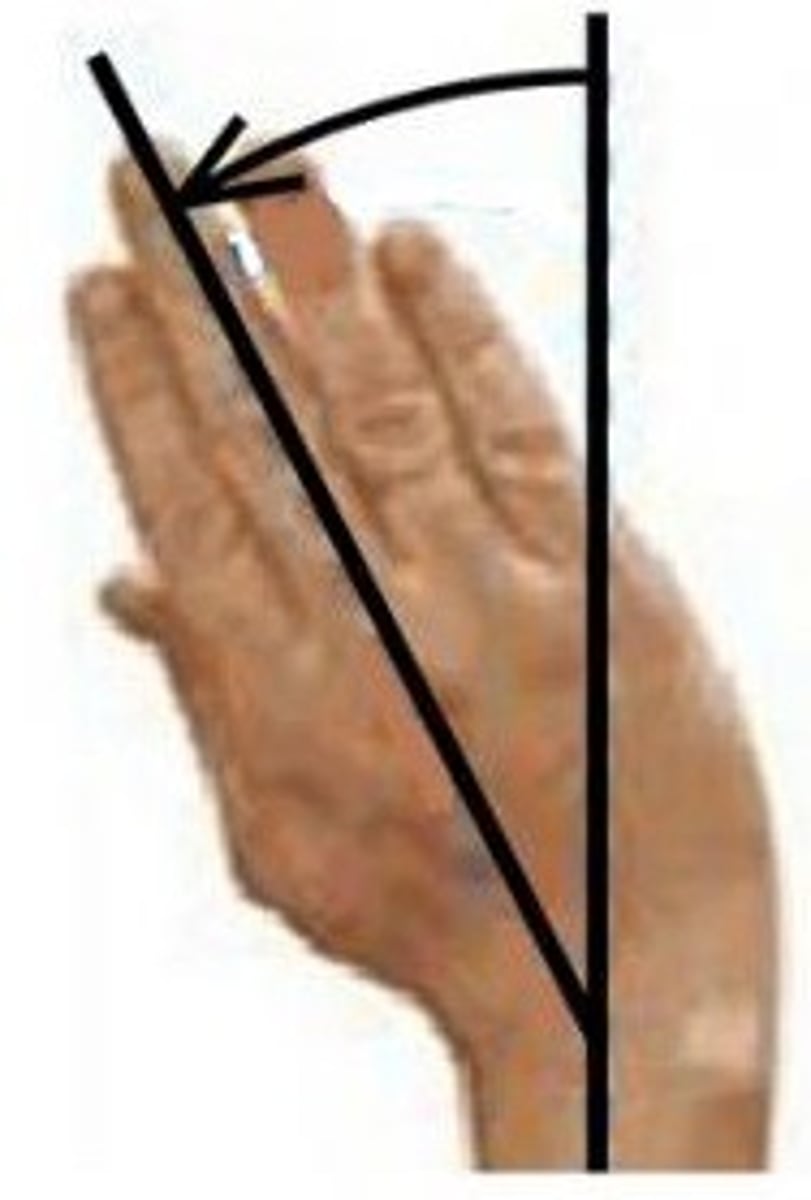 <p>Movement of the wrist towards the radius or lateral side; helps find lunate, triquetrum, pisiform, and hamate</p>