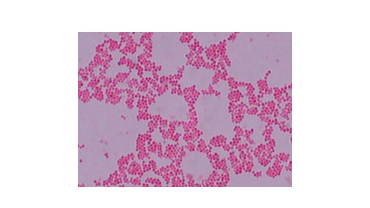 <p><span>looking at the micrograph, does the bacteria Staphylococcus sp. produce spores</span></p>