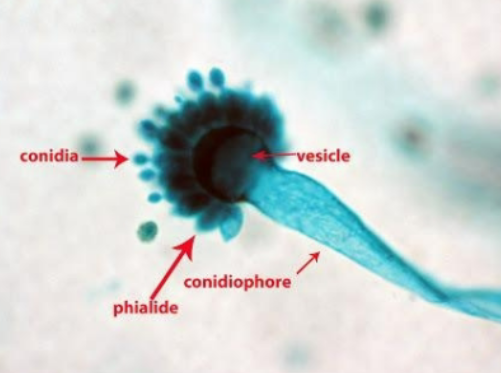 <p>Aspergillus</p><ol><li><p>Conidia</p></li><li><p>Vesicle</p></li><li><p>Phialide</p></li><li><p>Conidiophore</p></li></ol><p></p>