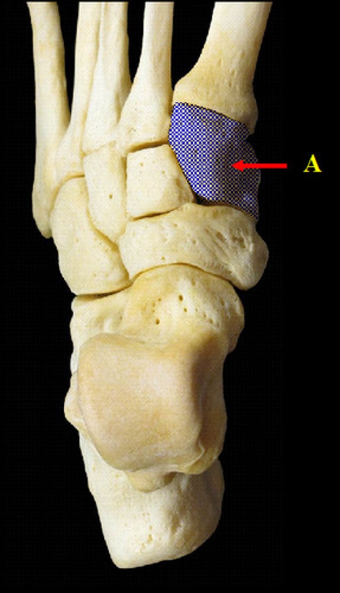 knowt flashcard image