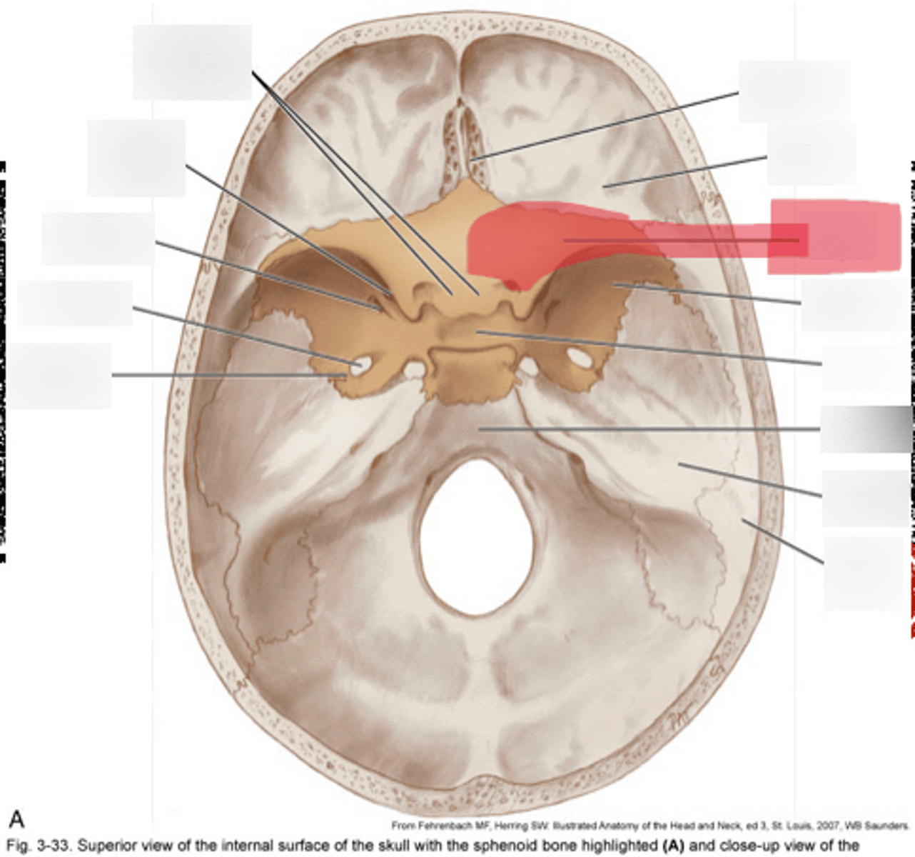 <p>Lesser wing of the sphenoid bone</p>