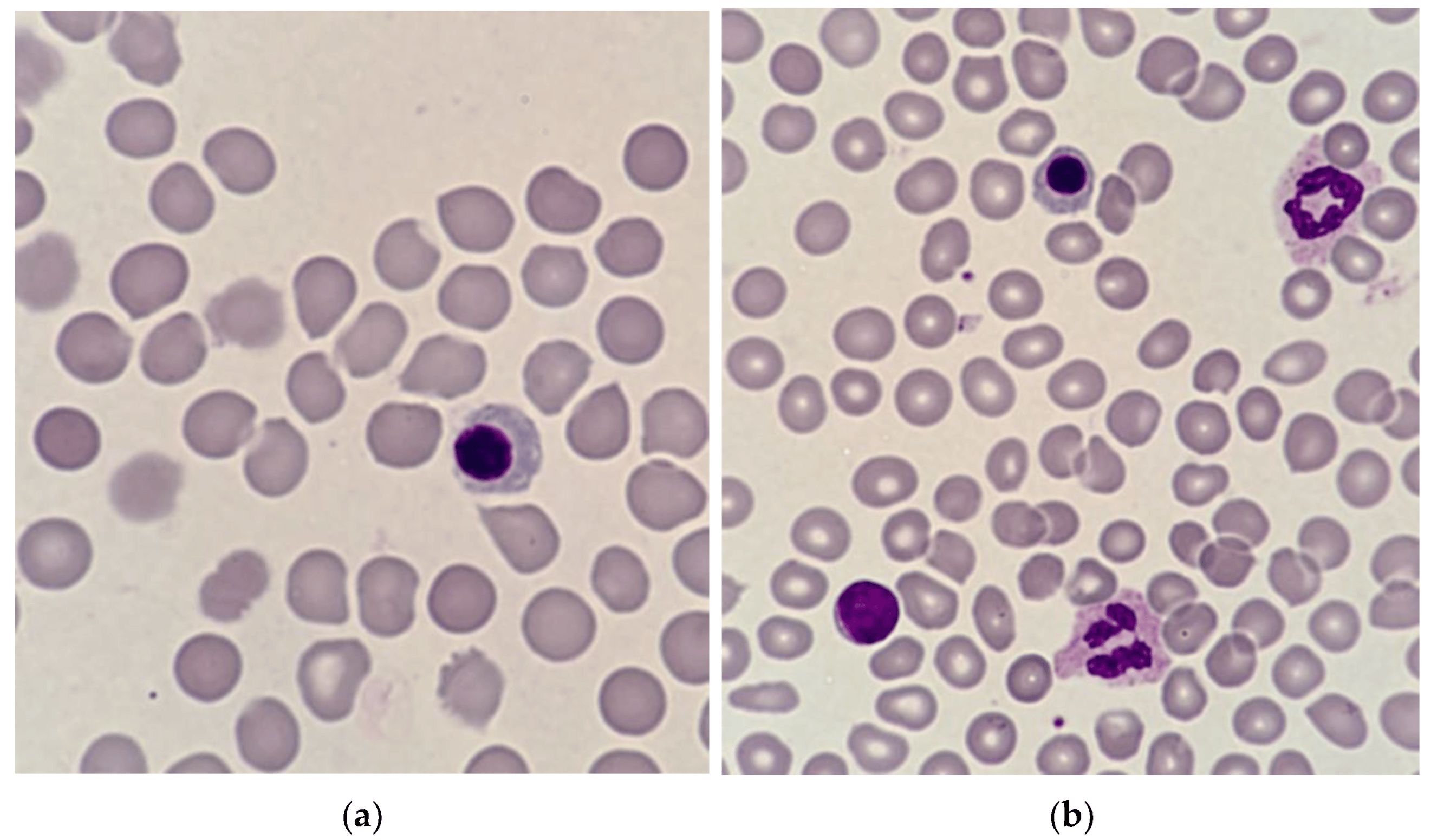 <p>nucleated RBCs</p>