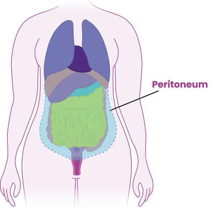 <ul><li><p>partial peritoneum lines wall of abdominal cavity</p></li><li><p>visceral peritoneum directly covers organs</p></li><li><p>peritoneum can be irritated by blood, pus, or bile causing peritonitis</p></li></ul><p></p>