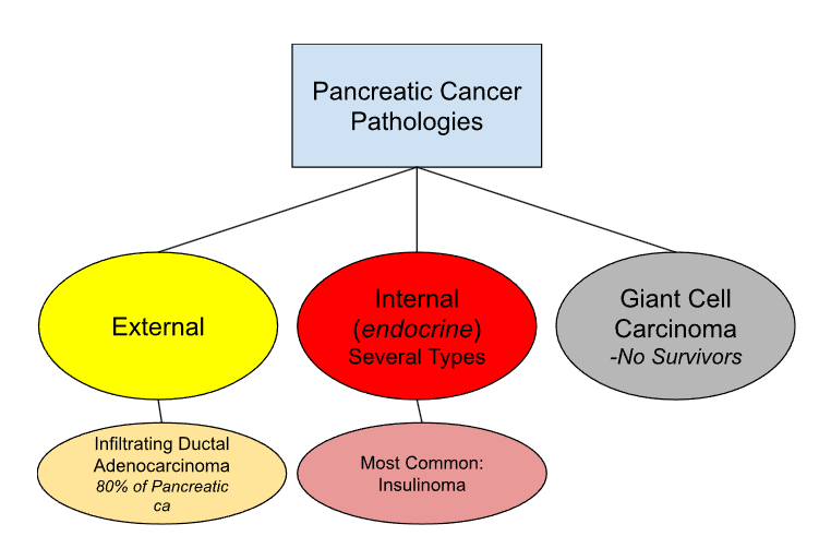 <p>Infiltrating Ductal Adenocarcinoma</p>