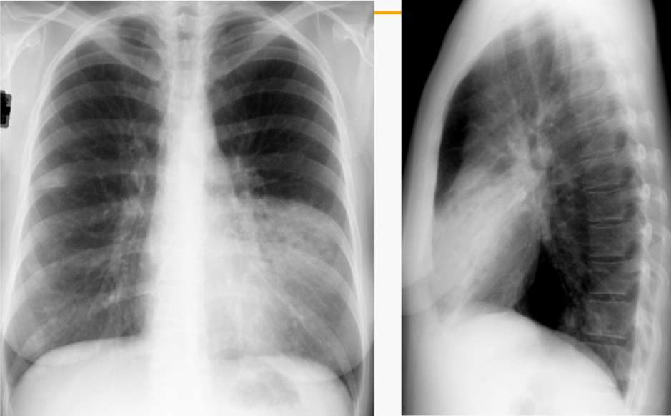 <p>What is this patient presenting with?</p>