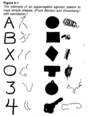 <p><span><span>The inability to recognise objects despite having intact sensory capabilities.</span></span></p>