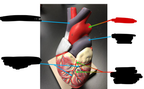 <p>Name this heart vessel</p>
