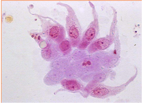 <p>These cells are present on sediment evaluation. What are they?</p>