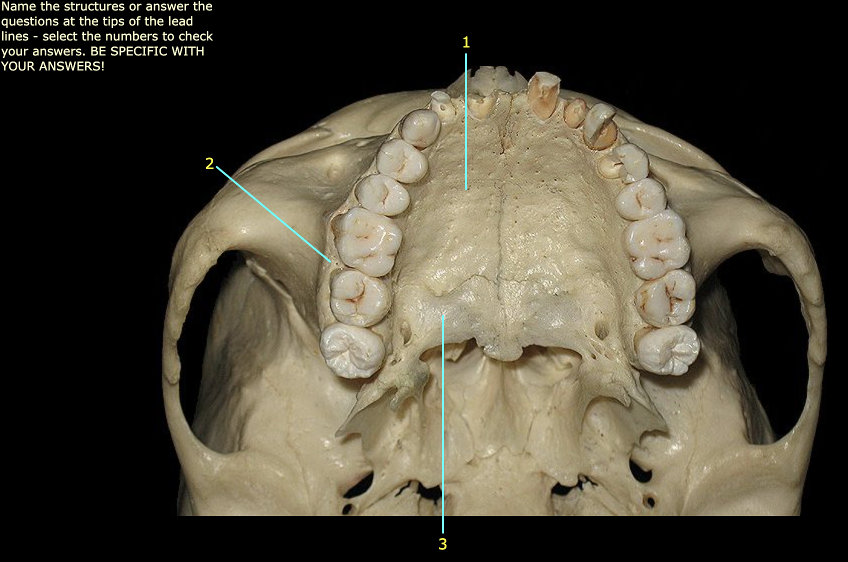 What structure is labeled 2?