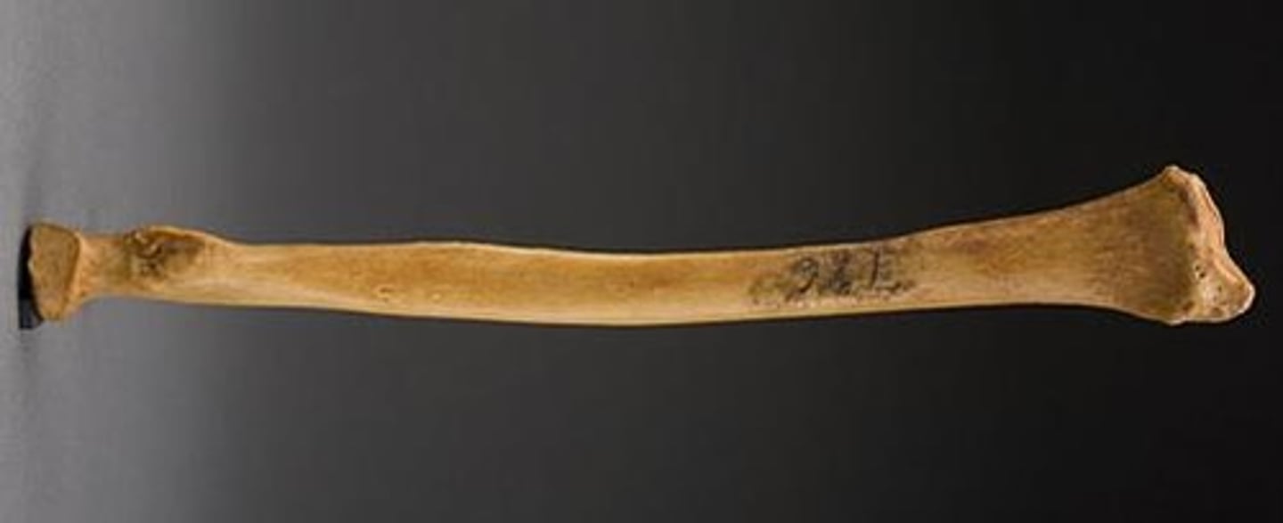 <p>ID bone</p>