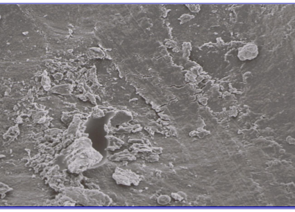 <ul><li><p>Acid etch technique: removal of smear layer, high energy surface</p></li><li><p>Dentine: dissolution of mineral phase, leaving exposed collagen network</p></li><li><p>when we remove the smear layer over dentine -<strong> we open up the dentine structur</strong>e</p></li><li><p>the dentine tubules are widened - because the intratubular which is <strong>highly mineralised, </strong>dissolves immediately</p></li><li><p>intertubular dentine loses the mineral - leaving a<strong><em> collagen network&nbsp; </em></strong>&nbsp;&nbsp;</p></li></ul><p></p>