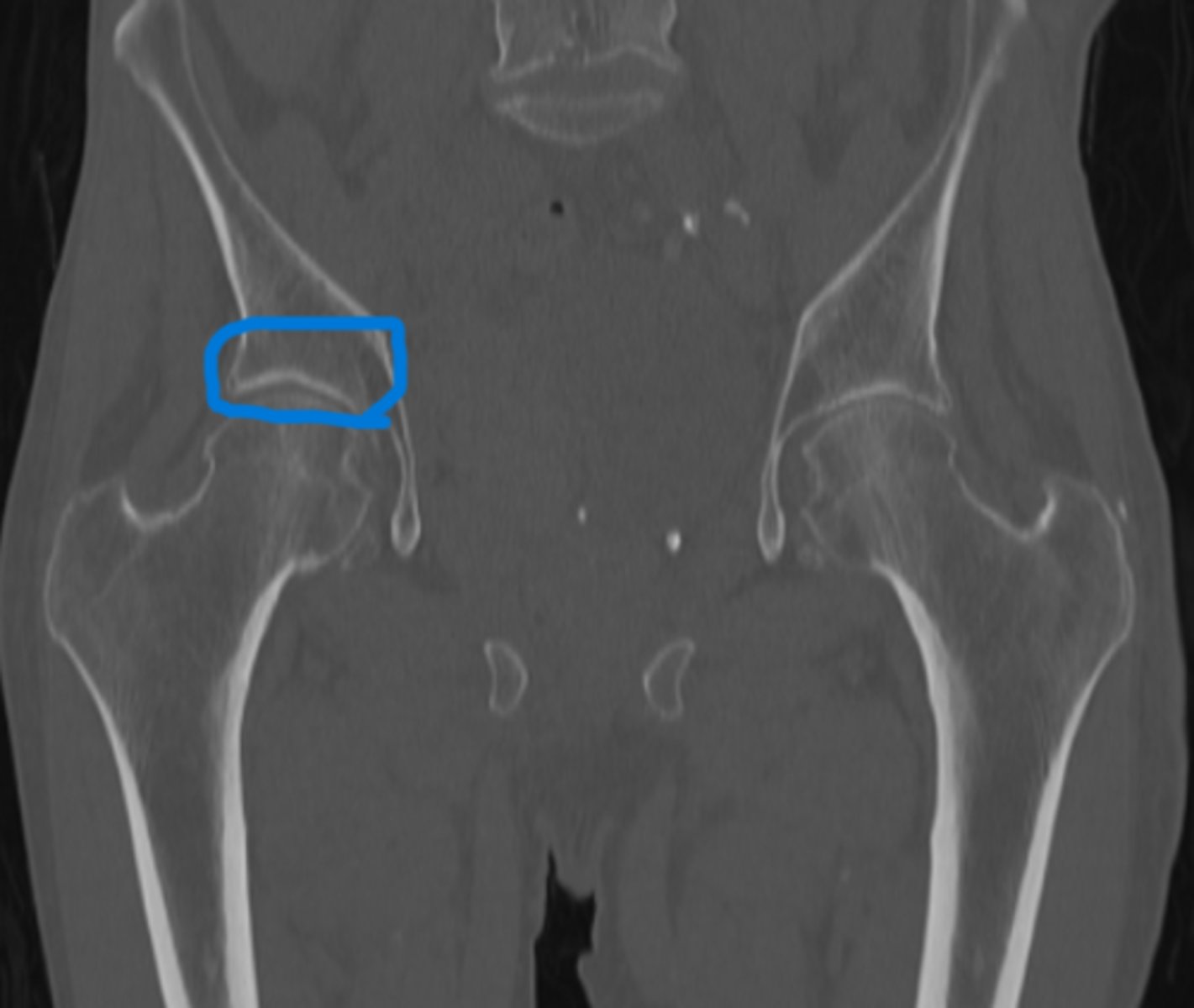 <p>What is the blue circle representing</p>