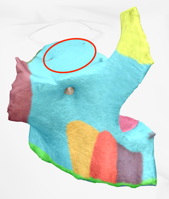 <p>place where orbits sit on maxilla </p>