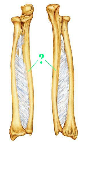 <p>Is the indicated bone from the right or left side of the body?</p>