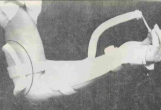 <p>Name this static splint component. What’s its function?</p>
