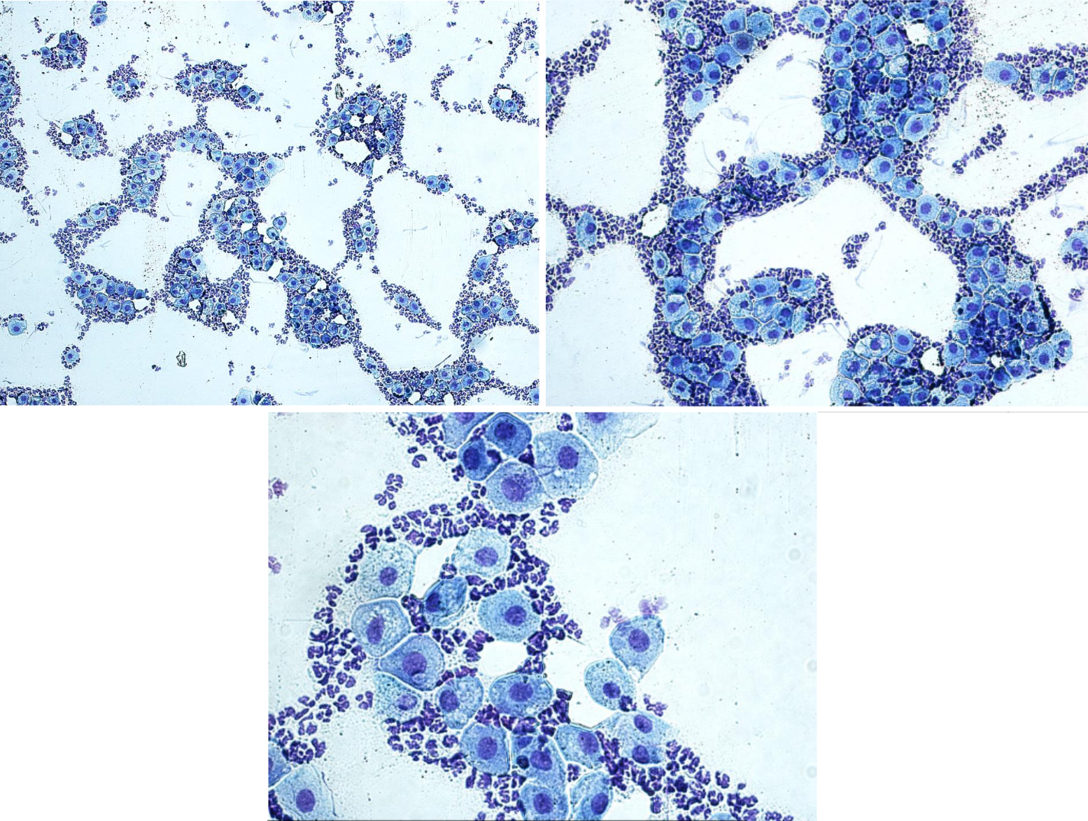 <p>Fall 3 - Silva, ung Siberian husky, 8 månader, 17,1 kg. Utsryk 4 mån efter tjuvparning, 40 dgr efter OHE.<br><br>Cellbild? Cykelstadie?</p>