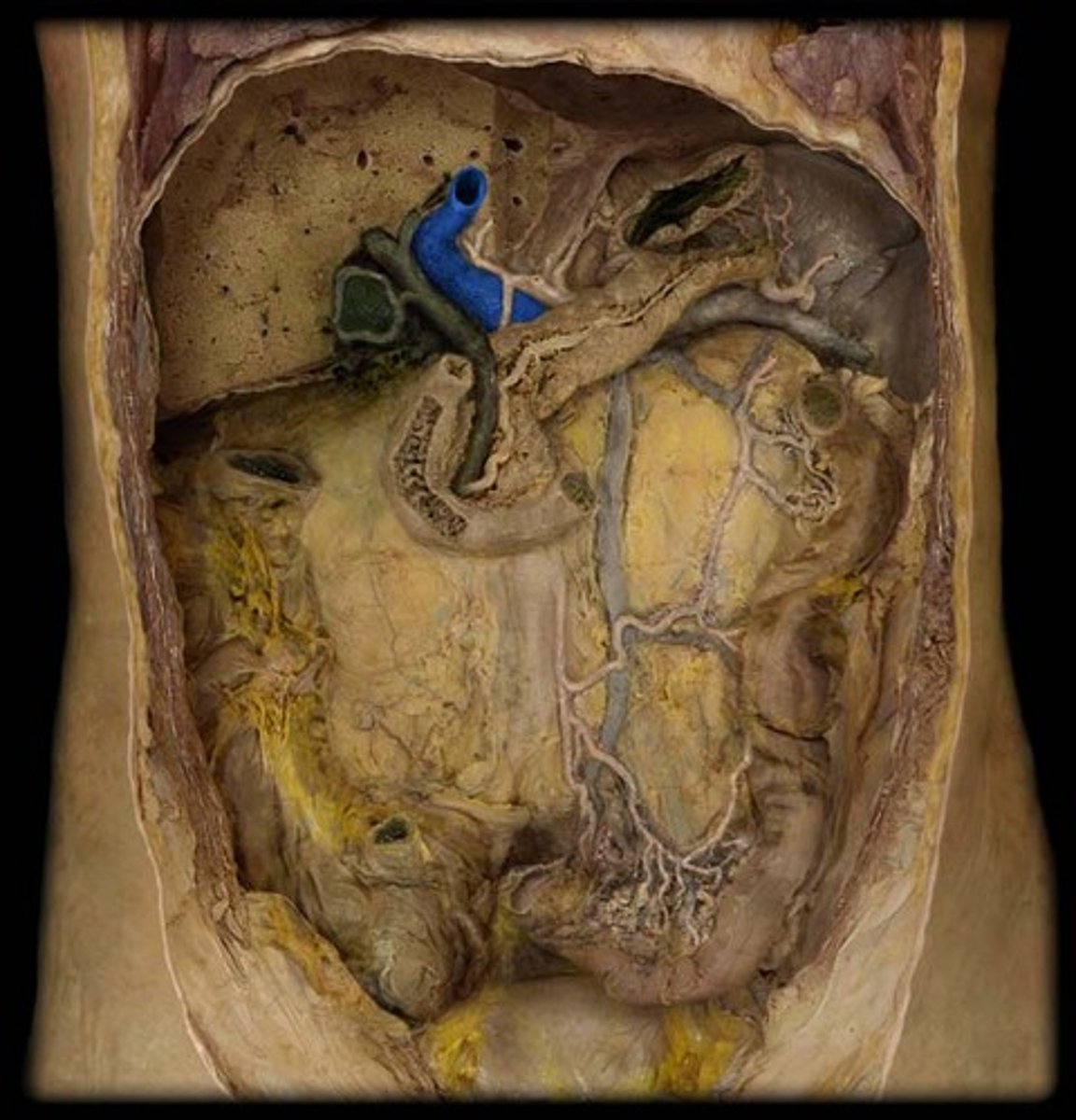 <p>Identify the vessel (include artery vs vein)</p>