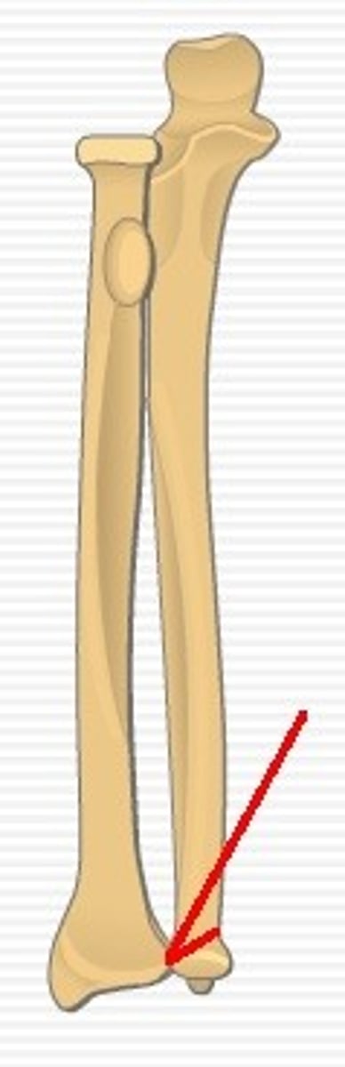 <p>synovial joint allows pronation/supination of the forearm ... shares capsule with the radiocarpal joint</p>