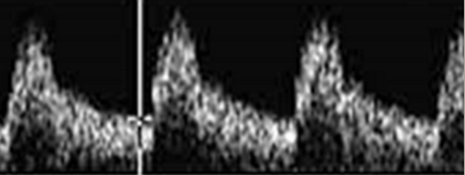 <p>What type of waveform is shown in the image?</p>
