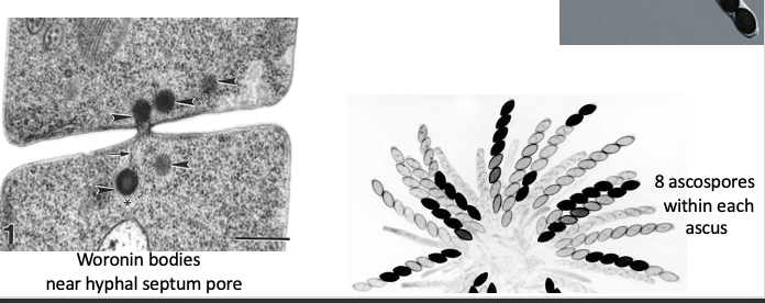 <ul><li><p>More than 50k species described<span> </span></p></li><li><p>Licensed - they take on green algae<span> </span></p></li><li><p>Commensal - grow within a living organism but don’t cause really any harm<span> </span></p></li><li><p>Most spend their life as haploid septate filaments<span> </span></p></li><li><p>Meiotic ascospores formed within a hypha called ascus - there are 8 ascospores within each ascus<span> </span></p></li></ul><p></p>