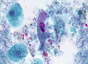Trophozoite E. histolytica 