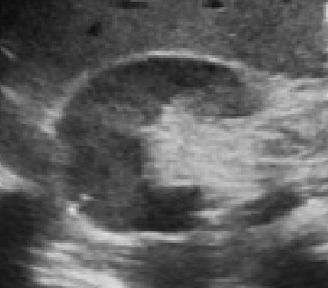 <p>is this a short or long axis of the kidney</p>