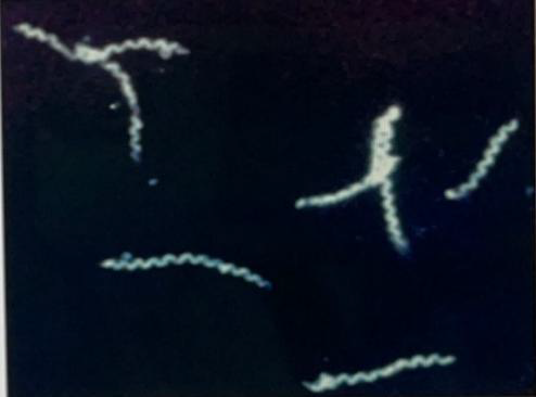 <ul><li><p>Identify the disease</p></li><li><p>Disease is caused by:</p></li><li><p>Oral manifestation</p></li></ul><p></p>