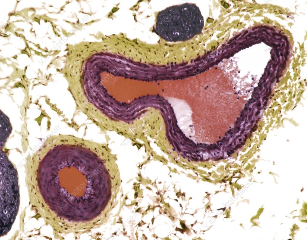 <p>Distinguishing Arteries and Veins in Micrographs</p>