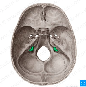<p>What landmark in the <strong>Temporal Region </strong>is this?</p>