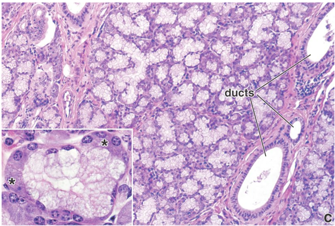<p>Which gland is this? Is it a serous, mucous, or mixed gland? What are some significant structures present?</p>