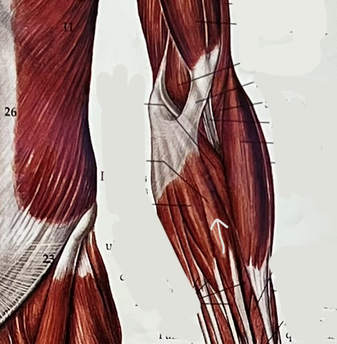 what muscle?