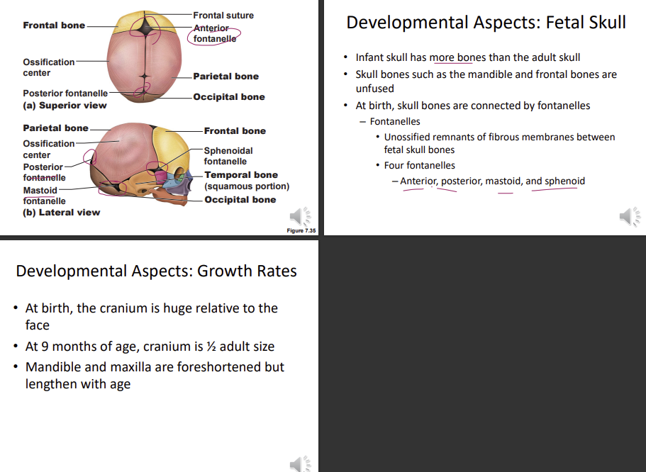 <p>the bones are separated from each other and not fully connected leading to fontanelle which is fibrous tissue present between bones, allows bones to overlap each other, they are growth sites</p><p>the </p><p>mastoid (left right movement and up and down) and styloid process not present - they develop during muscle attachment</p><p>skull is flat</p><p>the cranial is larger than the face</p><p>distance between mouth and orbit is small, as vertical growth of maxilla hasn’t occurred yet</p>