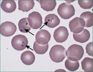 <p><strong>Late stages of Plasmodium vivax malaria produce these, what are they called?</strong></p>