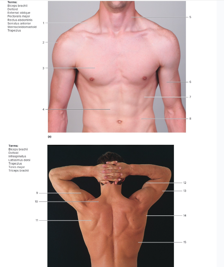 <p>Label the following: muscles</p>