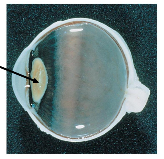 <p>The arrow is pointing to </p><p></p><p>a. Cornea</p><p>b. Conjunctiva</p><p>C. Lens</p><p>d. Aqueous humor</p>