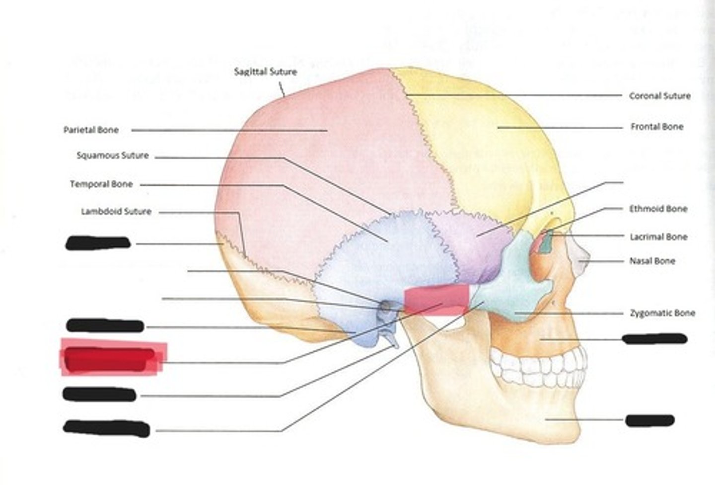 <p>Zygomatic process of the temporal bone</p>