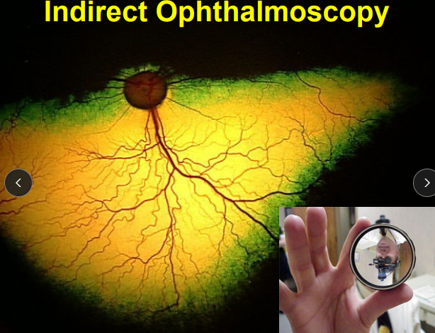 <p><span style="background-color: transparent;"><strong><span>Ophthalmoscopy</span></strong></span></p>