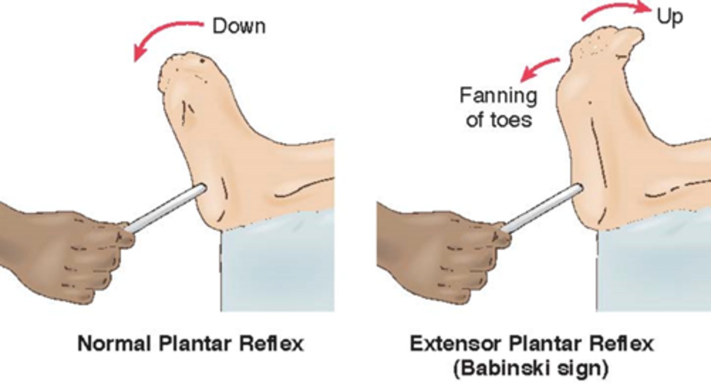 <p>dorsiflexion of the big toe and fanning of all toes</p>