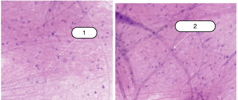 <p>Identify the structure labeled #1</p>